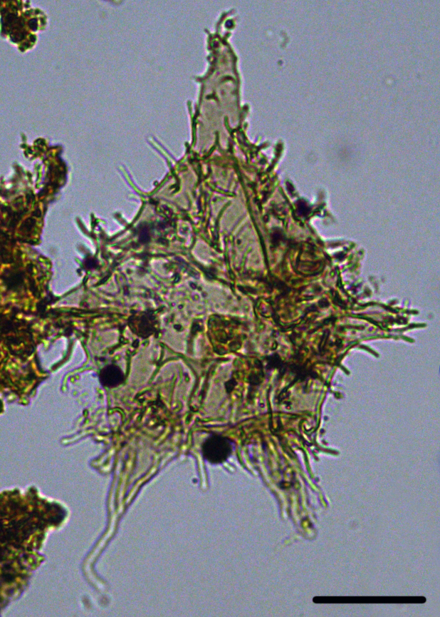 Apectodinium parvum PApa27X31011031701103b.jpg